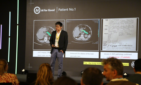 阿里达摩院公布多癌早筛AI最新进展:已服务2000万人次 阿里达摩院公布多癌早筛AI最新进展:已服务2000万人次